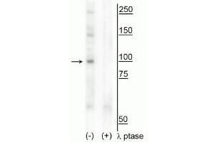 Western blot of human T47D cell lysate showing specific immunolabeling of the ~100 kDa CtIP phosphorylated at Thr847 in the first lane (-). (Retinoblastoma Binding Protein 8 抗体  (pThr847))