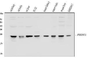 Western blot analysis of Peroxiredoxin 1 using anti-Peroxiredoxin 1 antibody (ABIN3043903). (Peroxiredoxin 1 抗体  (Middle Region))