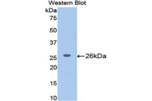 Western blot analysis of the recombinant protein. (MGEA5 抗体  (AA 19-222))