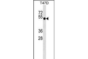 GLI4 Antibody (N-term) (ABIN1539446 and ABIN2849209) western blot analysis in T47D cell line lysates (35 μg/lane). (GLI4 抗体  (N-Term))