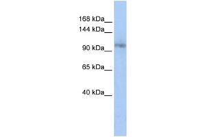 WB Suggested Anti-TCERG1 Antibody Titration:  0. (TCERG1 抗体  (Middle Region))