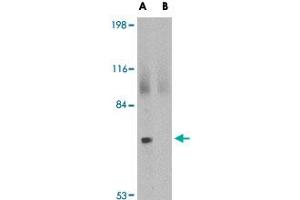 Western blot analysis of JPH2 in 293 cell lysate with JPH2 polyclonal antibody  at 2 ug/mL in (A) the absence and (B) the presence of blocking peptide. (Junctophilin 2 抗体  (C-Term))