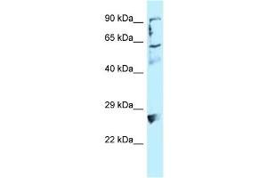 WB Suggested Anti-LIMA1 Antibody Titration: 1. (LIMA1 抗体  (C-Term))