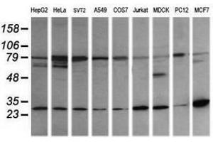 Image no. 4 for anti-RAB21, Member RAS Oncogene Family (RAB21) antibody (ABIN1500545) (RAB21 抗体)