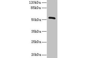 Western blot All lanes: ZNF410 antibody at 3 μg/mL + Mouse brain tissue Secondary Goat polyclonal to rabbit IgG at 1/10000 dilution Predicted band size: 53, 30, 48, 45, 56 kDa Observed band size: 53 kDa (ZNF41 抗体  (AA 1-300))