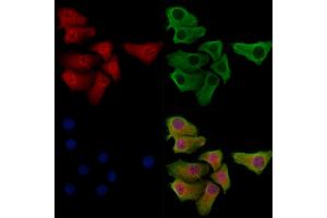 Phospho-SNAIL (Ser11) Antibody staining Hela cells(heat shock treatment) by IF/ICC. (SNAIL 抗体  (pSer11))