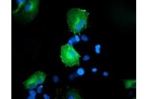 Anti-CCM2 mouse monoclonal antibody (ABIN2454939) immunofluorescent staining of COS7 cells transiently transfected by pCMV6-ENTRY CCM2 (RC201418). (CCM2 抗体)