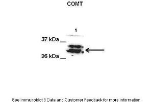 Lanes:   1. (COMT 抗体  (Middle Region))
