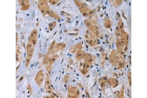 Immunohistochemistry (IHC) image for anti-C-Type Lectin Domain Family 1, Member A (CLEC1A) antibody (ABIN2427969)
