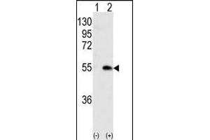 Western blot analysis of CK1G (arrow) using rabbit polyclonal CK1G (Center ) Antibody (ABIN391377 and ABIN2841388). (CAMK1G 抗体  (AA 211-241))