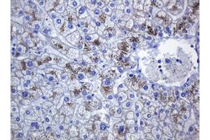 Image no. 10 for anti-Cadherin 1, Type 1, E-Cadherin (Epithelial) (CDH1) antibody (ABIN1497941) (E-cadherin 抗体)