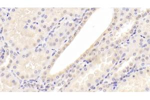 Detection of a2PI in Human Kidney Tissue using Monoclonal Antibody to Alpha 2-Antiplasmin (a2PI) (alpha 2 Antiplasmin 抗体)