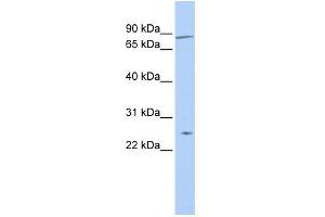 WB Suggested Anti-ZNF613 Antibody Titration:  0. (ZNF613 抗体  (N-Term))