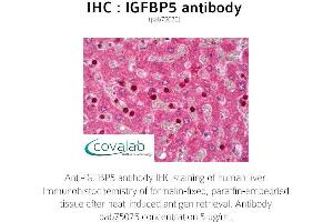 Image no. 1 for anti-Insulin-Like Growth Factor Binding Protein 5 (IGFBP5) (AA 192-206) antibody (ABIN1735787) (IGFBP5 抗体  (AA 192-206))