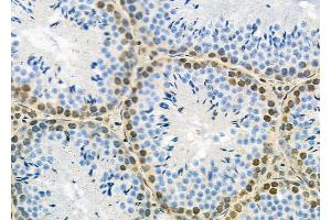 ABIN6263195 and ABIN6279528 at 1/100 staining Rat brain tissue by IHC-P. (MED29 抗体  (Internal Region))