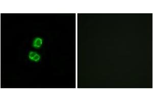 Immunofluorescence analysis of MCF7 cells, using FGF22 Antibody. (FGF22 抗体  (AA 71-120))