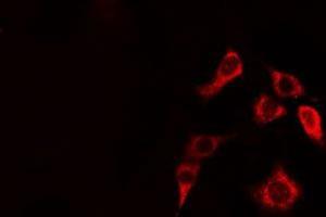 ABIN6274948 staining HepG2 cells by IF/ICC. (CLIP2 抗体  (C-Term))