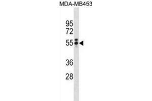 Western Blotting (WB) image for anti-T Antigen antibody (ABIN3001361) (T Antigen 抗体)