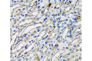 Immunohistochemistry (Paraffin-embedded Sections) (IHC (p)) image for anti-Coatomer Protein Complex, Subunit beta 2 (COPB2) antibody (ABIN7011528)