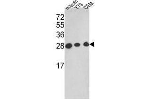 Western blot analysis of TPI1 Antibody (TPI1 抗体  (C-Term))