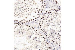 Immunohistochemistry of paraffin embedded mouse testis using sav1 (ABIN7075505) at dilution of 1:200 (400x lens) (SAV1 抗体)