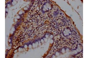 Immunohistochemistry (IHC) image for anti-Collagen, Type II, alpha 1 (COL2A1) (AA 201-217) antibody (ABIN7148200)