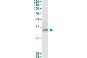 CA3 MaxPab rabbit polyclonal antibody. (CA3 抗体  (AA 1-260))