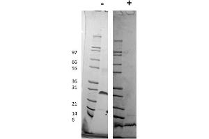 SDS-PAGE of Human Platelet Derived Growth Factor-BB Recombinant Protein SDS-PAGE of Human Platelet Derived Growth Factor-BB Recombinant Protein. (PDGF-BB Homodimer 蛋白)