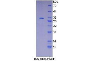 SDS-PAGE analysis of Human gSAP Protein. (GSAP 蛋白)