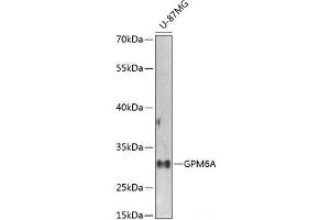 Western blot analysis of extracts of U-87MG cells using GPM6A Polyclonal Antibody at dilution of 1:1000. (GPM6A 抗体)
