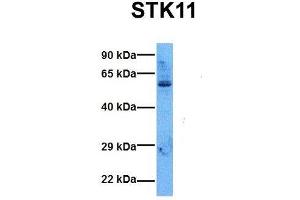 Host:  Rabbit  Target Name:  STK11  Sample Tissue:  Human 293T  Antibody Dilution:  1. (LKB1 抗体  (N-Term))