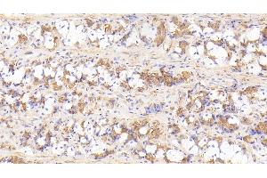 Detection of IL17RD in Human Stomach Tissue using Polyclonal Antibody to Interleukin 17 Receptor D (IL17RD) (IL17RD 抗体  (AA 157-299))