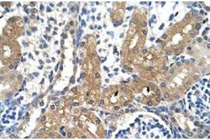 Immunohistochemical staining (Formalin-fixed paraffin-embedded sections) of human kidney with CYP4A22 polyclonal antibody  at 4-8 ug/mL working concentration. (CYP4A22 抗体  (N-Term))