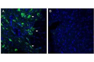 Immunohistochemistry (IHC) image for anti-Solute Carrier Family 6 (Neutral Amino Acid Transporter), Member 15 (SLC6A15) (AA 691-705), (Intracellular) antibody (ABIN7043747)