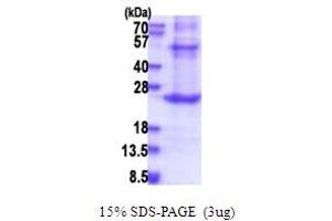SDS-PAGE (SDS) image for Protein C Receptor, Endothelial (PROCR) (AA 18-210) protein (His tag) (ABIN5853649) (PROCR Protein (AA 18-210) (His tag))