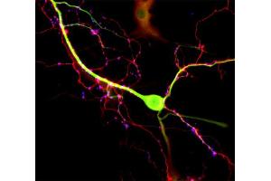 Immunofluorescence labeling of cultured hippocampus neurons (DIV 14) with anti-MAP 2, specific for dendrites (dilution 1 : 1000, green)and guinea-pig anti-Tau, specific for axons (Cat. (MAP2 抗体  (AA 2-309))