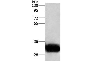 Western Blot analysis of Human fetal brain tissue using GPM6A Polyclonal Antibody at dilution of 1:950 (GPM6A 抗体)