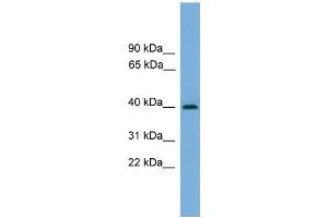 WB Suggested Anti-SERPINB8 Antibody Titration: 0. (SERPINB8 抗体  (Middle Region))