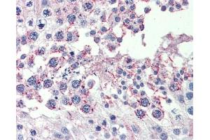 CPXCR1 antibody was used for immunohistochemistry at a concentration of 4-8 ug/ml. (CPXCR1 抗体  (Middle Region))