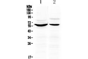 Western blot analysis of KPNA2 using anti-KPNA2 antibody .