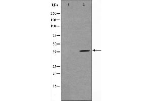 Western blot analysis on COLO205 cell lysate using TUSC3 Antibody,The lane on the left is treated with the antigen-specific peptide. (TUSC3 抗体  (Internal Region))