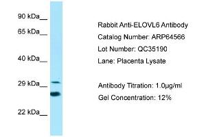 Western Blotting (WB) image for anti-ELOVL Fatty Acid Elongase 6 (ELOVL6) (N-Term) antibody (ABIN2789880) (ELOVL6 抗体  (N-Term))