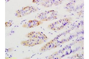 Formalin-fixed and paraffin embedded mouse stomach tissue labeled with Anti-Tenascin C/Tn-C Polyclonal Antibody, Unconjugated  at 1:200 followed by conjugation to the secondary antibody and DAB staining (TNC 抗体  (AA 1001-1100))