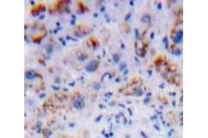 Used in DAB staining on fromalin fixed paraffin-embedded Liver tissue (Nicastrin 抗体  (AA 420-655))