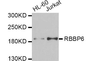 Western blot analysis of extracts of HL60 and Jurkat cell lines, using RBBP6 antibody. (RBBP6 抗体)