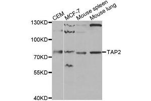 Western blot analysis of extracts of various cell lines, using TAP2 antibody. (TAP2 抗体)