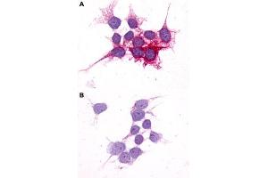 Immunocytochemistry (ICC) staining of HEK293 human embryonic kidney cells transfected (A) or untransfected (B) with P2RY14. (P2RY14 抗体  (C-Term))