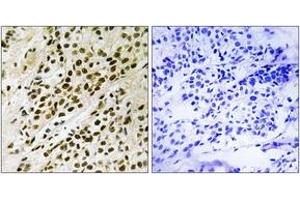 Immunohistochemistry (IHC) image for anti-Mitogen-Activated Protein Kinase-Activated Protein Kinase 5 (MAPKAPK5) (AA 148-197), (pThr182) antibody (ABIN1532150)