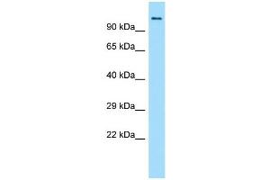 Host:  Rabbit  Target Name:  Brd4  Sample Type:  Rat Small Intestine lysates  Antibody Dilution:  1. (BRD4 抗体  (N-Term))