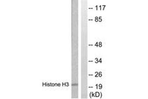 Western blot analysis of extracts from HuvEc cells, treated with Serum 20% 30', using Histone H3 (Ab-28) Antibody. (Histone 3 抗体  (AA 13-62))